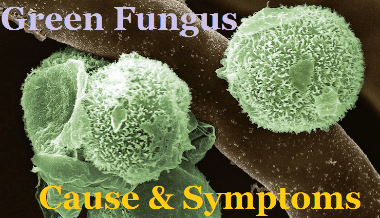 1st Case Of Green Fungus In India